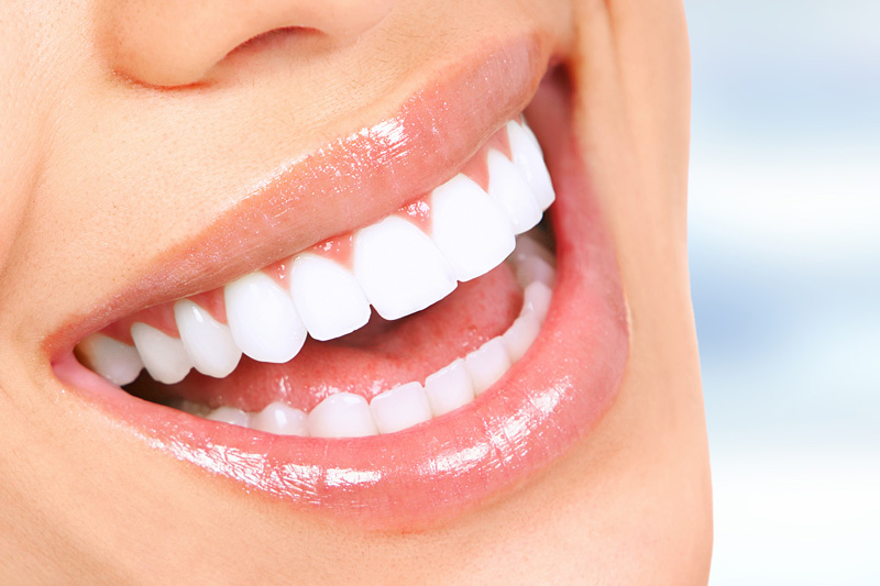 Cosmetic Dentistry in Reston