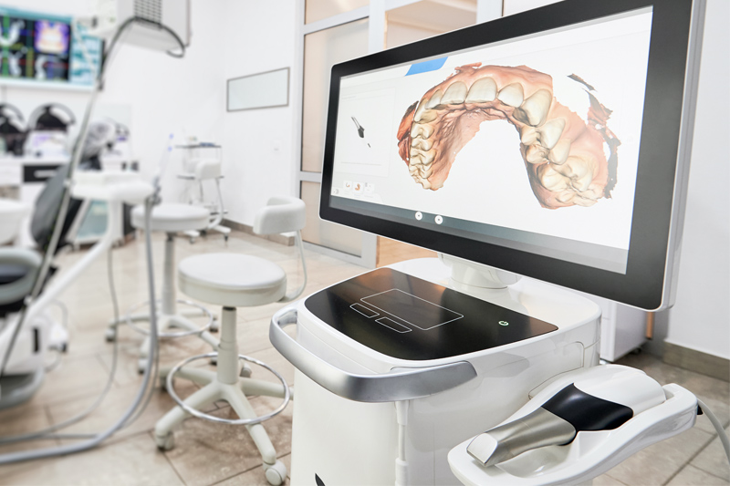 Itero Intra-Oral Scanner in Reston